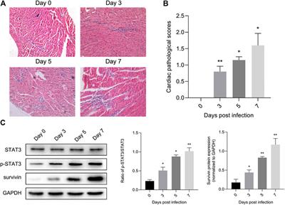 STAT3 Suppresses Cardiomyocytes Apoptosis in CVB3-Induced Myocarditis Via Survivin